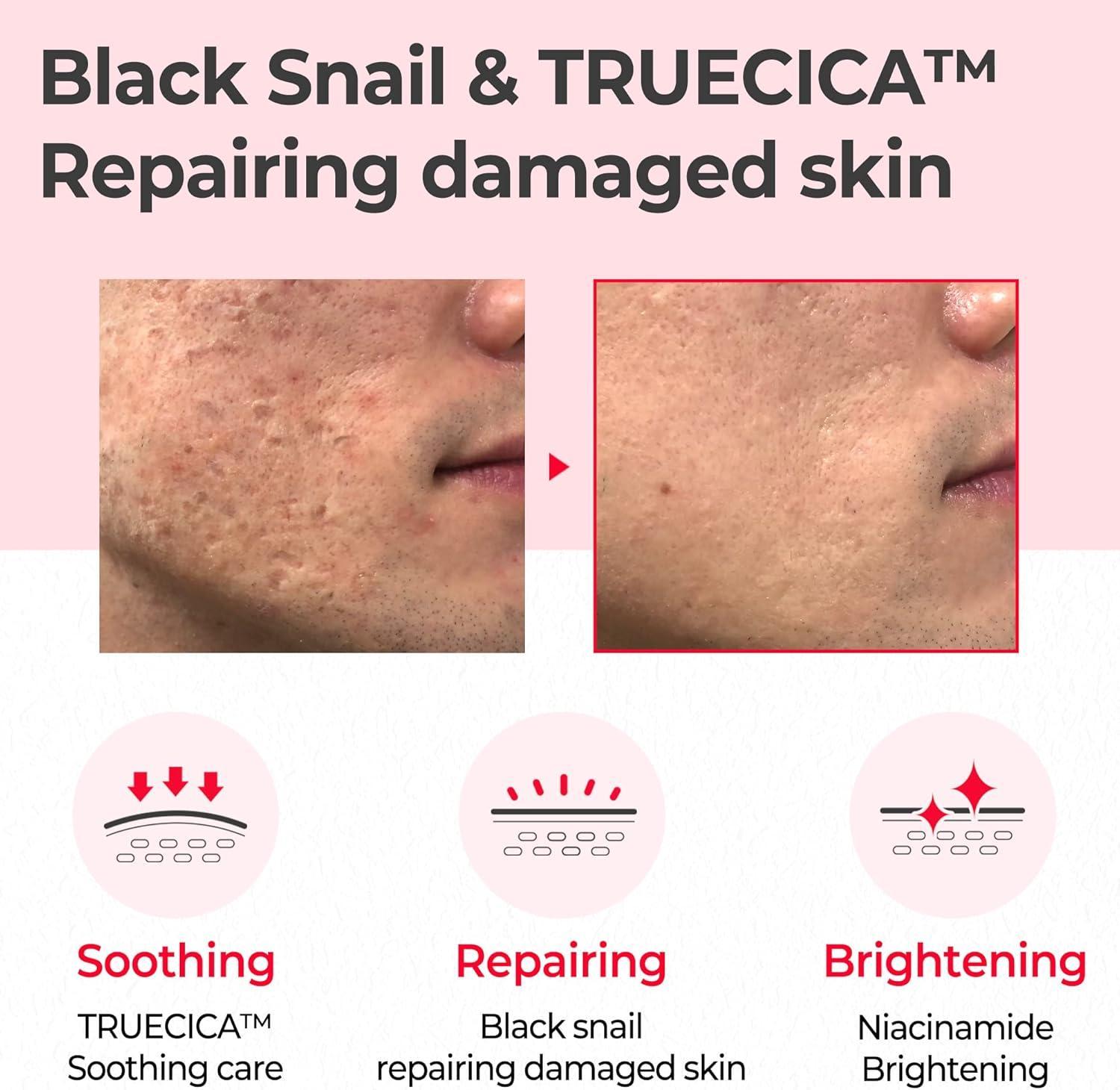 SNAIL TRUECICA MIRACLE REPAIR TONER 150ml