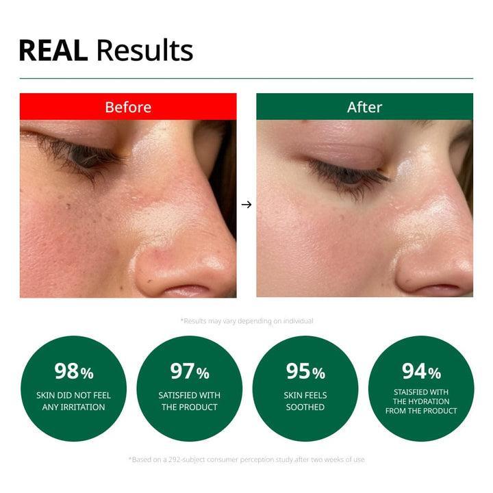 Red Blemish Clear Soothing Cream 70ml