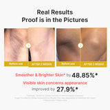Kojic Acid Turmeric Body Peel Shot 280ml